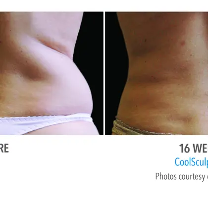 81Db75a5 9F48 4D10 856B 57A16e2bcdf7 Source V