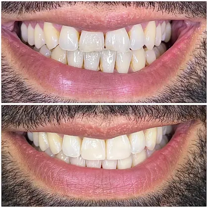 6580965E D1d4 48Eb 9Aca A6c23b1046d3