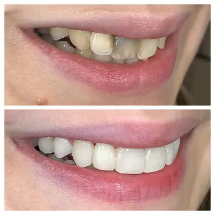 Facetune 23 12 2021 01 01 47