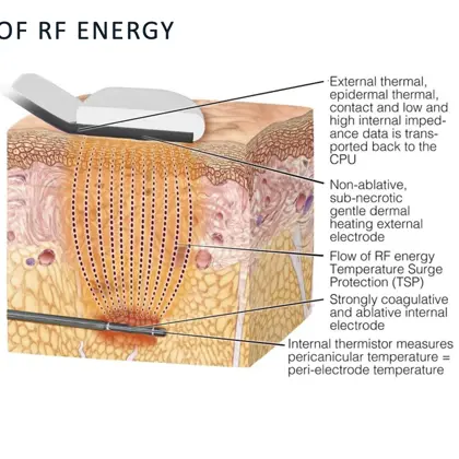 Screenshot 2023 05 22 At 14.05.40