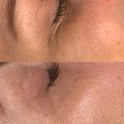 Fire And Ice Nina Before And After