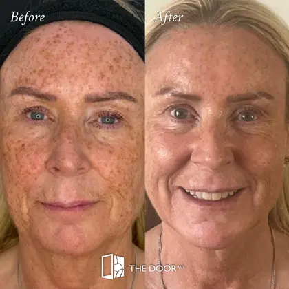 202607 Before and Afters, July 2026 003b