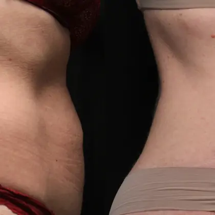 MC M8body 1E Abdomen