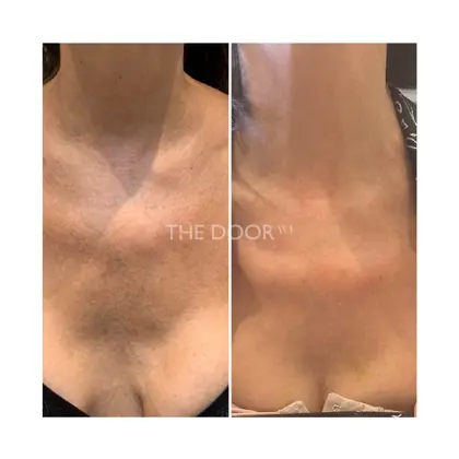 Before & Afters Dr Natasha 10