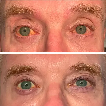 Envision Lumecca Before And After 03 2 Copy (1)