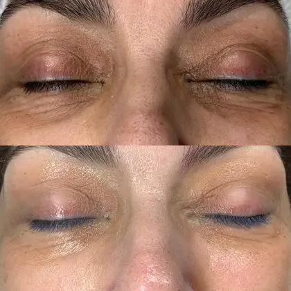 625Fc58f 2D41 48B4 9158 989A0795e6dd