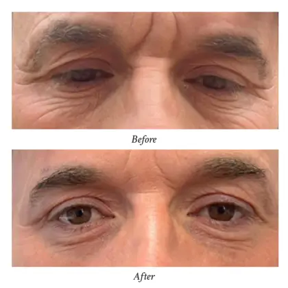 202603 Before and After (4) - Dr Kalin Tanov.jpg