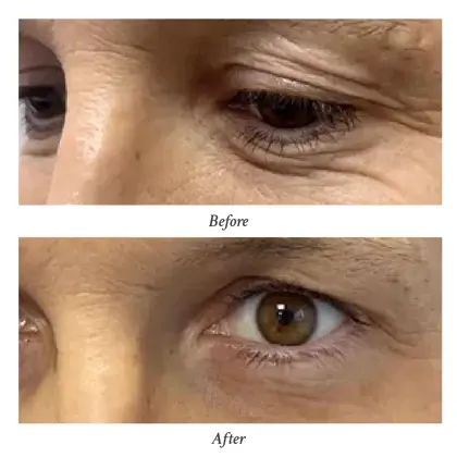 202603 Before and After (5) - Dr Kalin Tanov.jpg