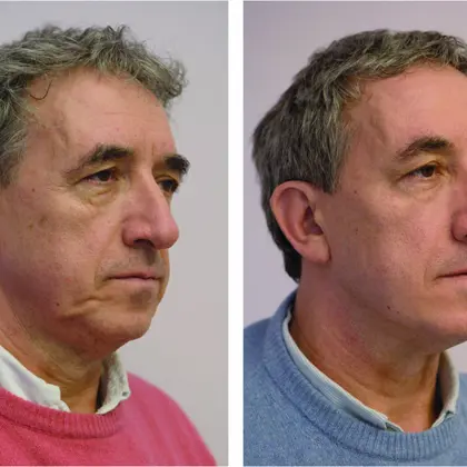 MEN BEFORE & AFTER PROFILE Copy