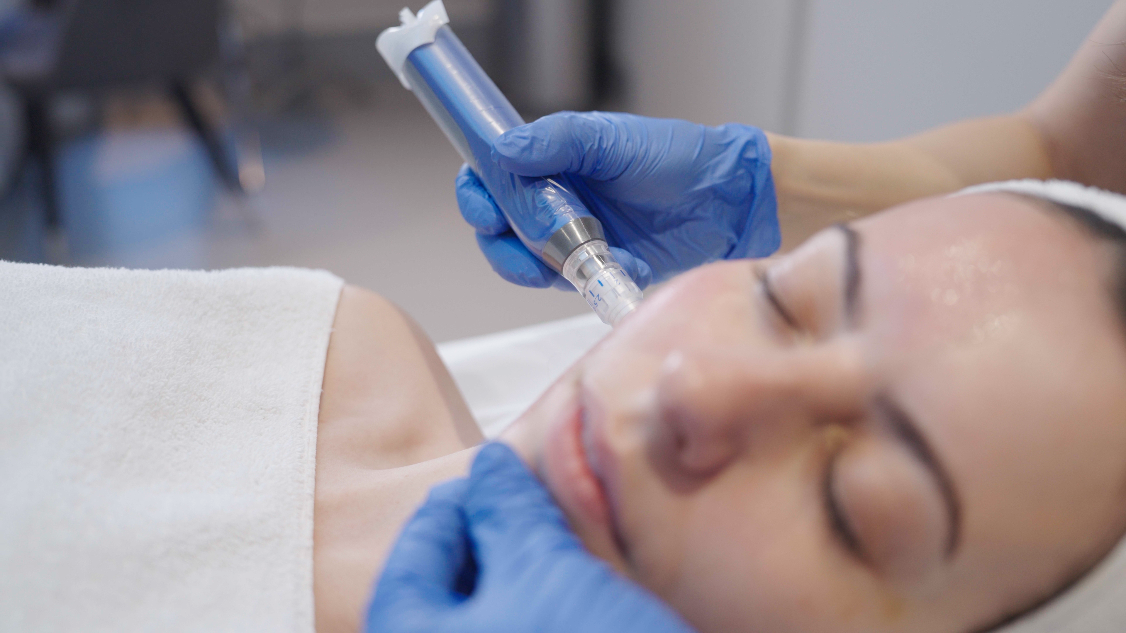 1. SkinPen® Microneedling