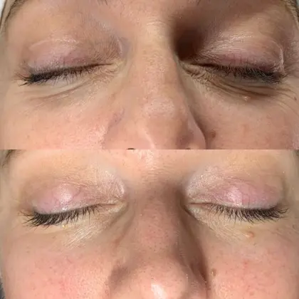 Gold Sarah Before And After