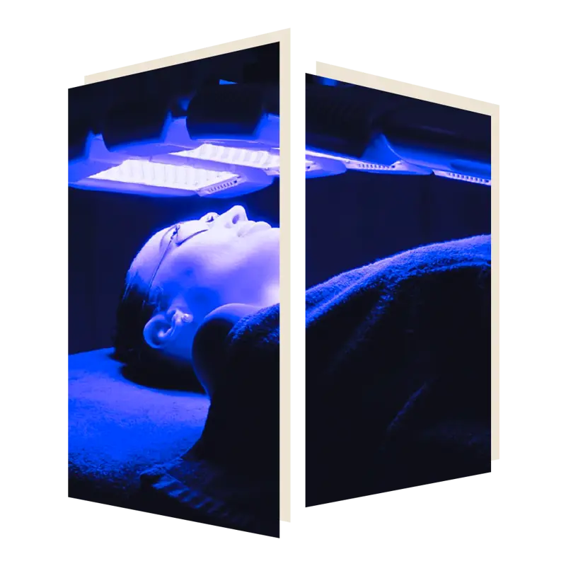 Dermaluxe Triwave Facial Treatment