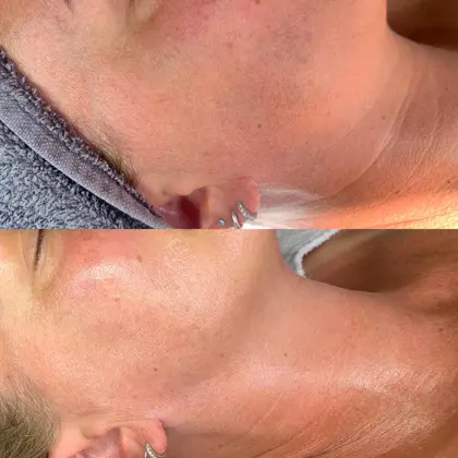 Bespoke Facial With Victoria 3