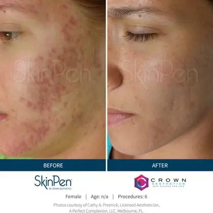 Before-and-After-Picture-CA-5.jpg (1)