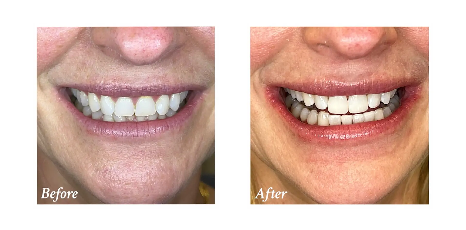 helen taylor before and after 2