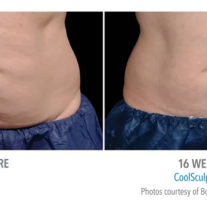 Ec9136b5 5510 46C9 B9ce 60Dd259fb2a5 Source V